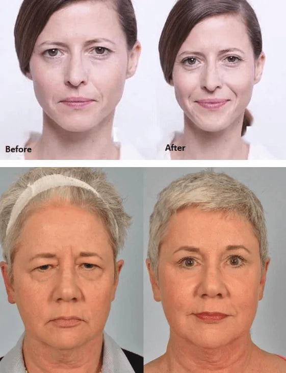 Organic Invisible Double Eyelids Kit